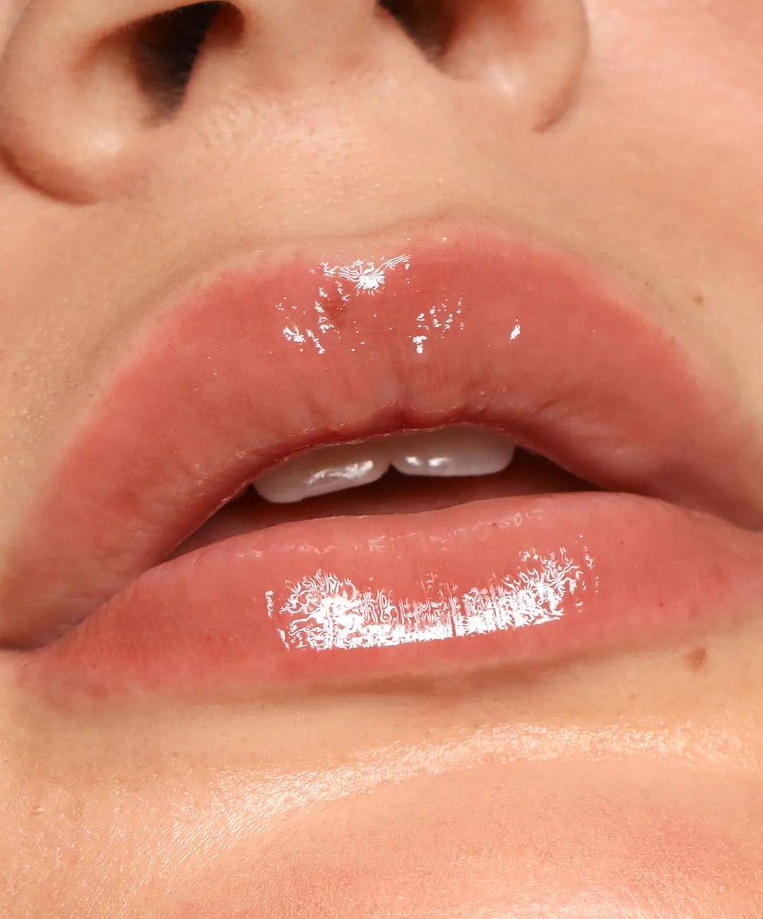 Refy Lip Gloss lucidalabbra shine idratante
